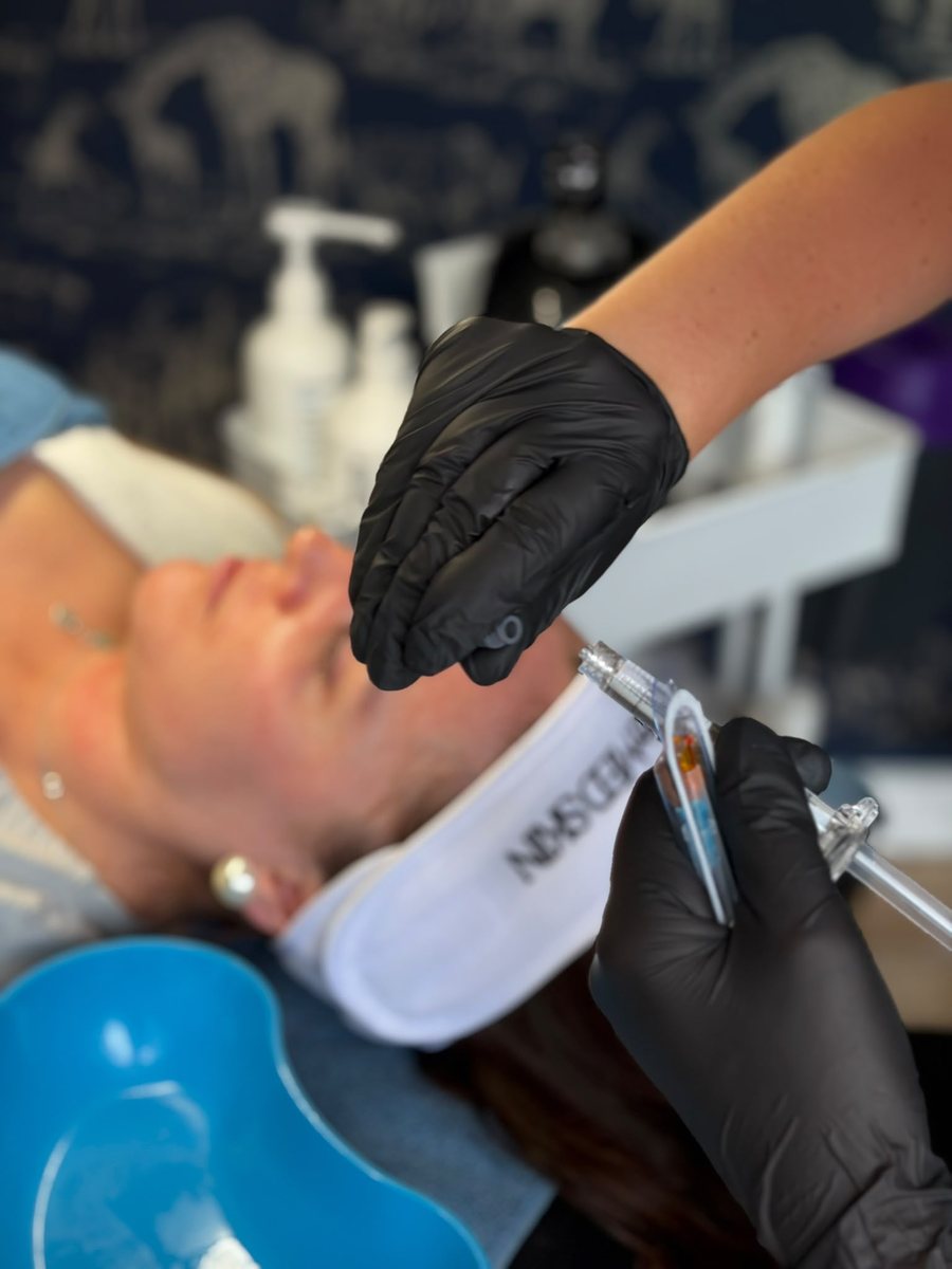 Skin booster injection being prepared at The Modern Skin Clinic
